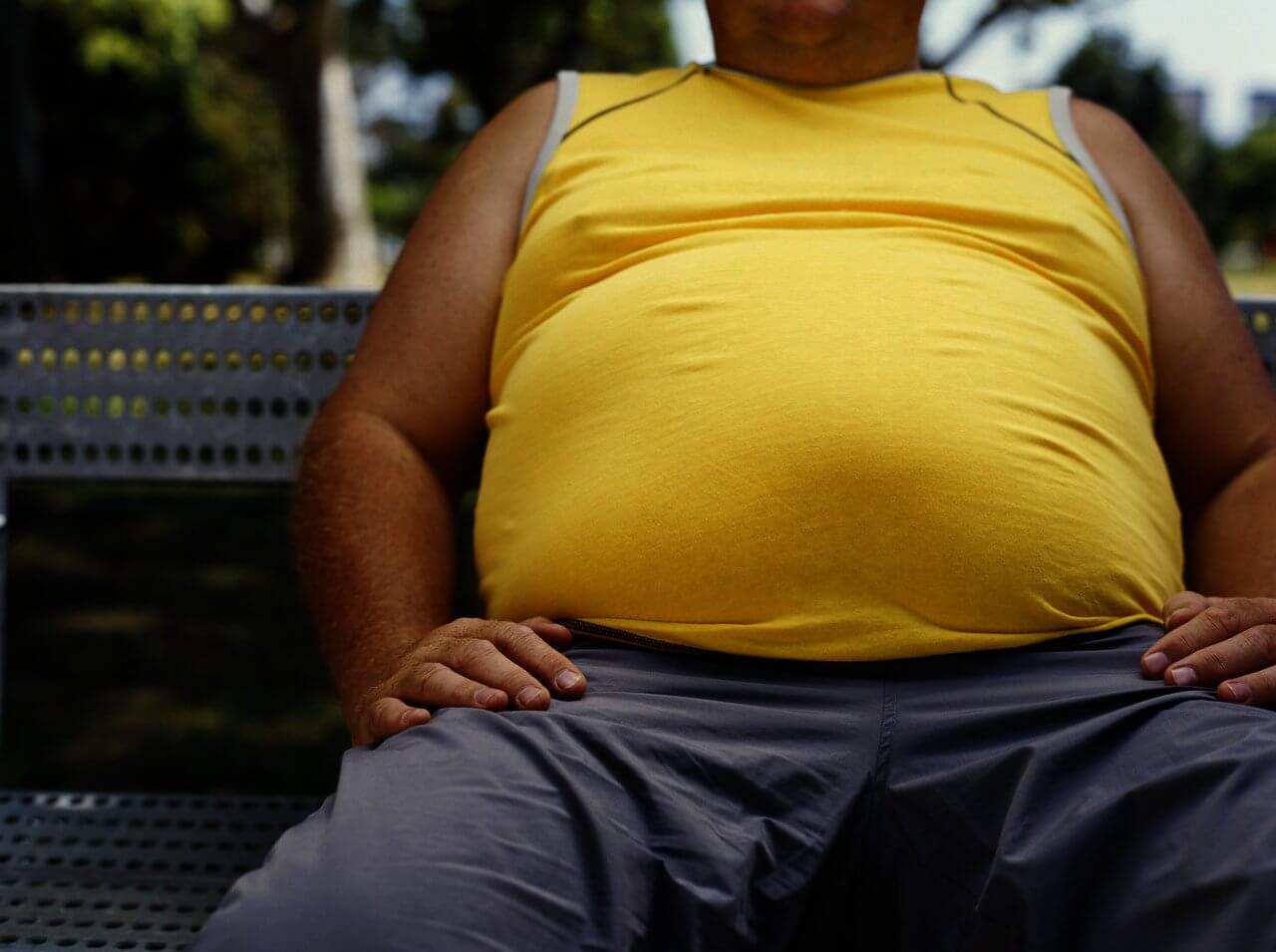définition obésité