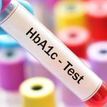 Qu’est-ce que l’hémoglobine glyquée (HbA1c) ? + tableau de correspondance