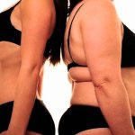 Graisse sous cutanée: Comment la déstocker ?